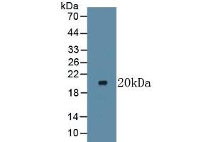 Detection of Recombinant LTbR, Human using Monoclonal Antibody to Lymphotoxin Beta Receptor (LTbR) (LTBR anticorps  (AA 66-215))