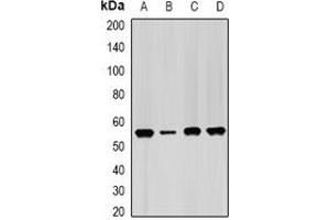 Western blot analysis of IMPDH2 expression in Hela (A), PC3 (B), mouse spleen (C), mouse heart (D) whole cell lysates. (IMPDH2 anticorps)