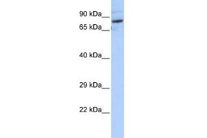 WB Suggested Anti-SPTLC2 Antibody Titration:  0. (SPTLC2 anticorps  (N-Term))