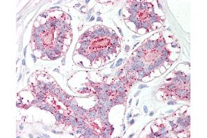 Anti-MAGEA1 / MAGE 1 antibody IHC of human breast.