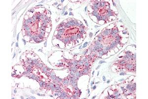 Anti-MAGEA1 / MAGE 1 antibody IHC of human breast.