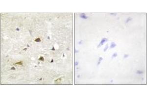 Immunohistochemistry analysis of paraffin-embedded human brain tissue, using IKK-beta (Ab-188) Antibody. (IKBKB anticorps  (AA 161-210))