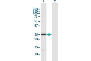 Western Blot analysis of ITGB1BP3 expression in transfected 293T cell line by ITGB1BP3 MaxPab polyclonal antibody. (ITGB1BP3 anticorps  (AA 1-230))