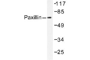 Image no. 2 for anti-Paxillin (PXN) antibody (ABIN271779) (Paxillin anticorps)