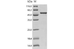 (Tris-Glycine gel) Discontinuous SDS-PAGE (reduced) with 5 % enrichment gel and 15 % separation gel.