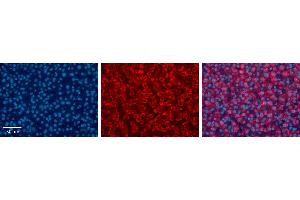 UGT1A6 antibody - C-terminal region          Formalin Fixed Paraffin Embedded Tissue:  Human Liver Tissue    Observed Staining:  Cytoplasm in hepatocytes   Primary Antibody Concentration:  1:100    Other Working Concentrations:  1/600    Secondary Antibody:  Donkey anti-Rabbit-Cy3    Secondary Antibody Concentration:  1:200    Magnification:  20X    Exposure Time:  0.