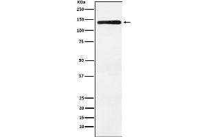Western blot analysis of Bub1 expression in K562 cell lysate.