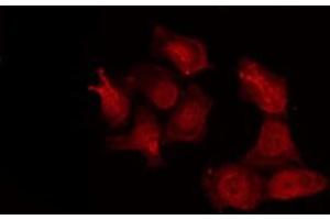 ABIN6277264 staining NIH-3T3 by IF/ICC. (MMP14 anticorps  (C-Term))