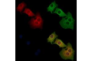 ABIN6260500 and ABIN6268739 staining Hela cells by IF/ICC. (Cathepsin D anticorps  (C-Term))
