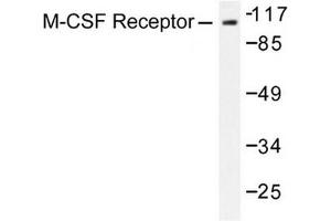 Image no. 1 for anti-Colony Stimulating Factor 1 Receptor (CSF1R) antibody (ABIN272017) (CSF1R anticorps)