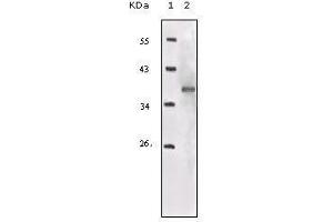 Western blot analysis using IGF1R-Beta mouse mAb against truncated IGF1R recombinant protein. (IGF1R-beta (AA 1101-1367) anticorps)