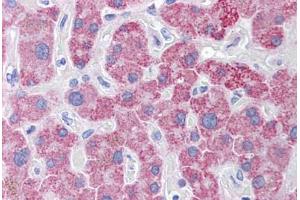 Human Liver: Formalin-Fixed, Paraffin-Embedded (FFPE)