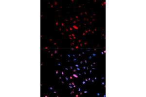 Immunofluorescence analysis of U2OS cell using Phospho-c-Jun-Ser73 antibody. (C-JUN anticorps  (pSer73))