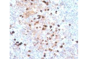 IHC testing of human tonsil stained with IgM heavy chain antibody.