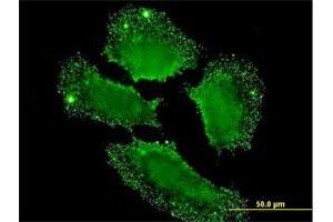 Immunofluorescence of monoclonal antibody to SH2D3C on HeLa cell. (SH2D3C anticorps  (AA 1-110))