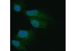 IF analysis of PKR/EIF2AK2 using anti-PKR/EIF2AK2 antibody (ABIN3043824).