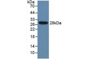 Western blot analysis of recombinant Mouse CYP2E1. (CYP2E1 anticorps  (AA 34-273))