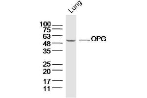 Mouse lung lysates probed with OPG Polyclonal Antibody, Unconjugated  at 1:300 dilution and 4˚C overnight incubation.