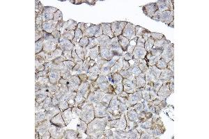 Immunohistochemistry of paraffin-embedded mouse pancreas using GNB2 Rabbit pAb  at dilution of 1:100 (40x lens).