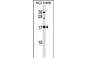 Western blot analysis in NCI-H460 cell line lysates (35ug/lane). (RPL12 anticorps  (AA 71-100))