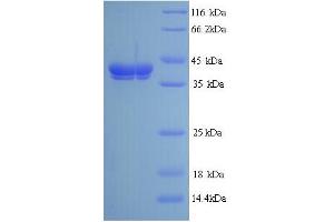 PLY1 (AA 22-367) protein (His tag)