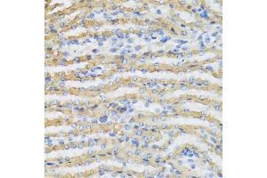 Immunohistochemistry of paraffin-embedded mouse kidney using C4BPB antibody (ABIN5973770) at dilution of 1/100 (40x lens). (C4BPB anticorps)