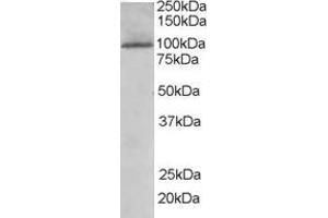 Western Blotting (WB) image for anti-TAO Kinase 3 (TAOK3) (Internal Region) antibody (ABIN2465861) (TAO Kinase 3 anticorps  (Internal Region))