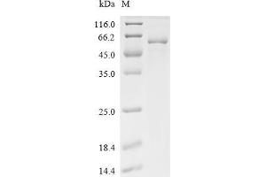 (Tris-Glycine gel) Discontinuous SDS-PAGE (reduced) with 5 % enrichment gel and 15 % separation gel.