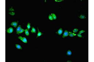 Immunofluorescent analysis of HepG2 cells using ABIN7151222 at dilution of 1:100 and Alexa Fluor 488-congugated AffiniPure Goat Anti-Rabbit IgG(H+L)