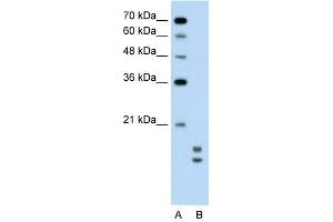 UBE2L3 antibody used at 0. (UBE2L3 anticorps  (C-Term))