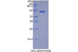 SDS-PAGE analysis of Human HIST1H2AD Protein. (HIST1H2AD Protéine)