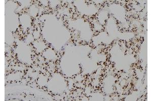 ABIN6277432 at 1/100 staining Rat lung tissue by IHC-P.