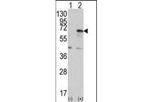 Western blot analysis of EIF2AK2 (arrow) using PRKR Antibody (C-term) (ABIN392779 and ABIN2837995). (EIF2AK2 anticorps  (C-Term))
