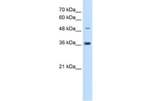 Western Blotting (WB) image for anti-Iroquois Homeobox Protein 1 (IRX1) antibody (ABIN2463089) (IRX1 anticorps)