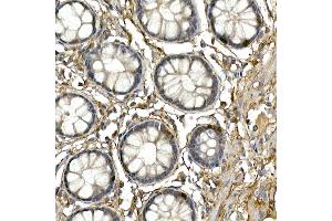 Immunohistochemistry of paraffin-embedded human colon using NEUROG3 Rabbit pAb (ABIN3016653, ABIN3016654, ABIN3016655 and ABIN6219805) at dilution of 1:250 (40x lens).