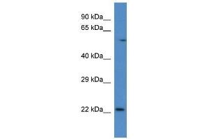 Western Blot showing Rab10 antibody used at a concentration of 1.