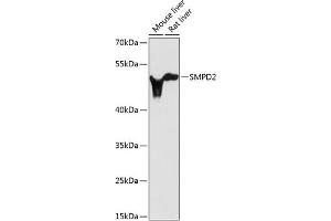 Western blot analysis of extracts of various cell lines, using SMPD2 antibody (ABIN3021604, ABIN3021605, ABIN3021606 and ABIN6215351) at 1:3000 dilution. (SMPD2 anticorps  (AA 150-250))