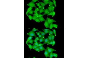 Immunofluorescence analysis of A549 cell using PRKD3 antibody. (PRKD3 anticorps)