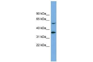 SLC7A7 antibody used at 1 ug/ml to detect target protein. (SLC7A7 anticorps)