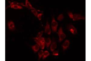 ABIN6274975 staining HepG2 by IF/ICC. (CPT1B anticorps  (Internal Region))