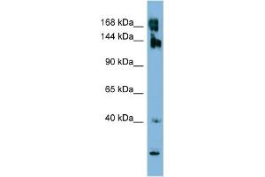 WB Suggested Anti-WNK3 Antibody Titration:  0. (WNK3 anticorps  (N-Term))