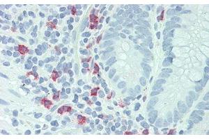 Detection of IL23R in Human Small Intestine Tissue using Polyclonal Antibody to Interleukin 23 Receptor (IL23R)