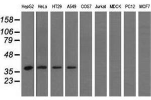 Western blot analysis of extracts (35 µg) from 9 different cell lines by using anti-HIBCH monoclonal antibody. (HIBCH anticorps)