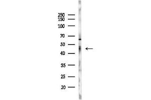 anti-Pre-B-Cell Leukemia Homeobox 4 (PBX4) (Internal Region) antibody