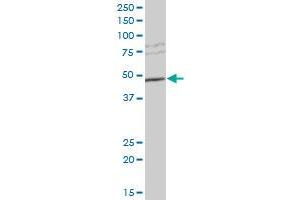 SULT2B1 polyclonal antibody (A01), Lot # 060707JCS1.