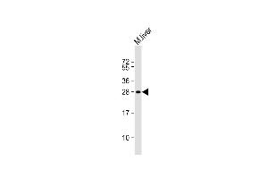 Anti-MOUSE Sike1 Antibody (N-term) at 1:1000 dilution + mouse liver lysate Lysates/proteins at 20 μg per lane. (SIKE1 anticorps  (N-Term))
