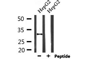 Western blot analysis of extracts from HepG2, using HO-1 Antibody. (HMOX1 anticorps  (Internal Region))
