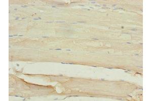 Immunohistochemistry of paraffin-embedded human skeletal muscle tissue using ABIN7159955 at dilution of 1:100