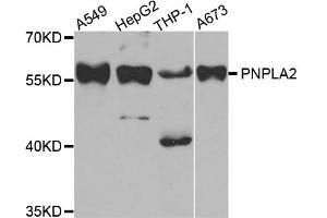 Western blot analysis of extracts of various cell lines, using PNPLA2 antibody. (PNPLA2 anticorps)