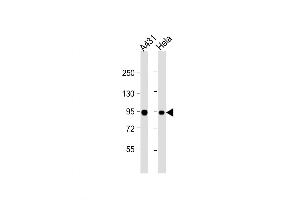 Western Blot at 1:1000 dilution Lane 1: A431 whole cell lysate Lane 2: Hela whole cell lysate Lysates/proteins at 20 ug per lane. (HSP90AB1 anticorps  (AA 403-431))